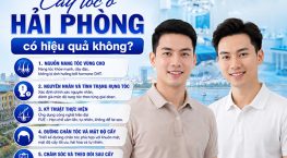 Cấy tóc ở Hải Phòng có hiệu quả không? 5 yếu tố quyết định kết quả