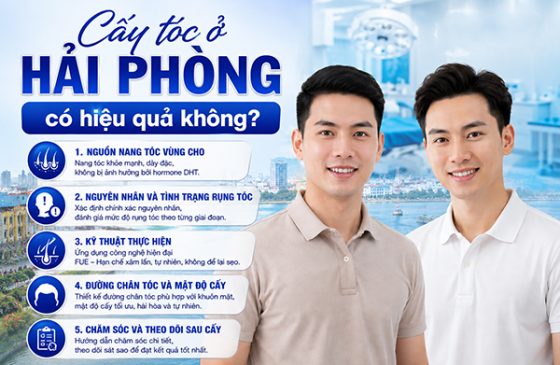 Cấy tóc ở Hải Phòng có hiệu quả không?