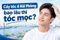 Cấy tóc ở Hải Phòng bao lâu thì tóc mọc?