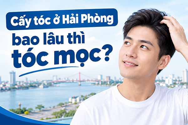 Cấy tóc ở Hải Phòng bao lâu thì tóc mọc?