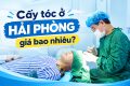 Cấy tóc ở Hải Phòng bao nhiêu tiền?