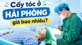 Cấy tóc ở Hải Phòng giá bao nhiêu? Bảng giá chi tiết theo phương pháp