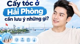 Cấy tóc ở Hải Phòng cần lưu ý những gì? Những điều bạn cần biết
