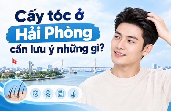 cấy tóc ở hải phòng cần lưu ý những gì