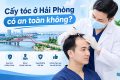 Cấy tóc ở Hải Phòng có an toàn không