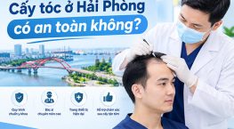 Cấy tóc ở Hải Phòng có an toàn không? Rủi ro và yếu tố cần lưu ý
