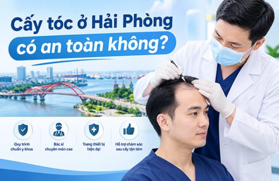Cấy tóc ở Hải Phòng có an toàn không