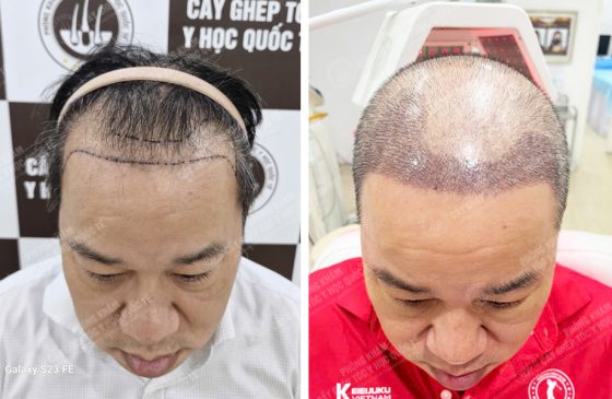 Võ Tấn Phát