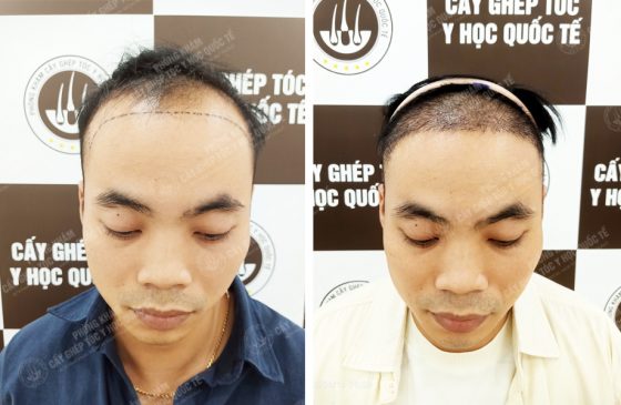 Nguyễn Hồng Đức