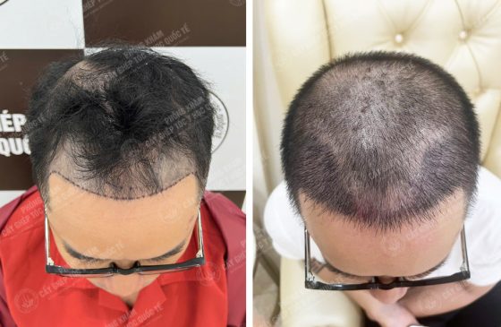 Trương Văn Quang
