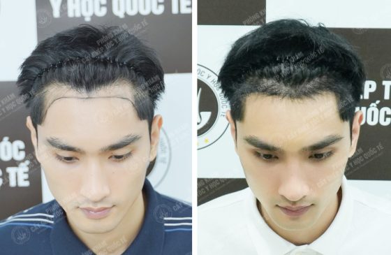 Nguyễn Huy Quang