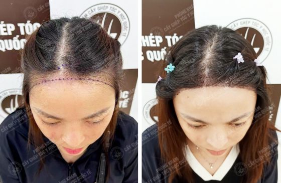 Đỗ Thị Thùy