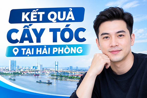Kết quả cấy tóc tại Hải Phòng thực tế sau 1 năm