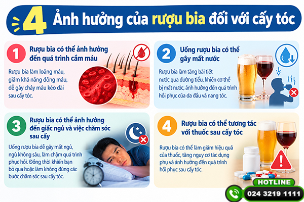 Tại sao không nên uống rượu bia trước và sau khi cấy tóc?