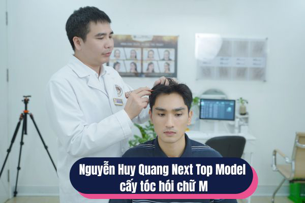 Nguyễn Huy Quang Next Top Model cấy tóc hói chữ M
