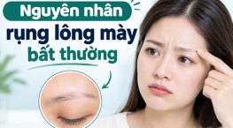 7 Nguyên nhân rụng lông mày bất thường bạn không nên bỏ qua