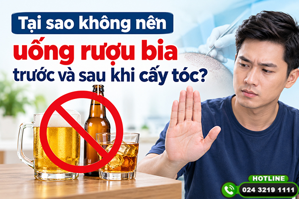 Tại sao không nên uống rượu bia trước và sau khi cấy tóc?