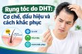 Rụng tóc do DHT: Cơ chế, dấu hiệu và cách khắc phục hiệu quả