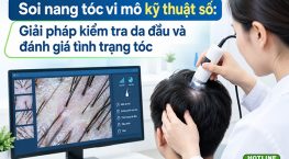 Soi nang tóc vi mô kỹ thuật số: Giải pháp kiểm tra da đầu và đánh giá tình trạng tóc