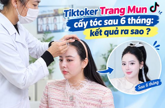 Trang Mun cấy tóc sau 6 tháng thay đổi ra sao