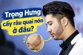 Trọng Hưng cấy râu quai nón ở đâu