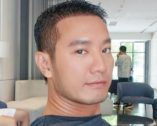 Youtuber Hùng Lâm sau 6 tháng cấy tóc