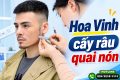 Hoa Vinh cấy râu quai nón: Hành trình thay đổi diện mạo nam tính