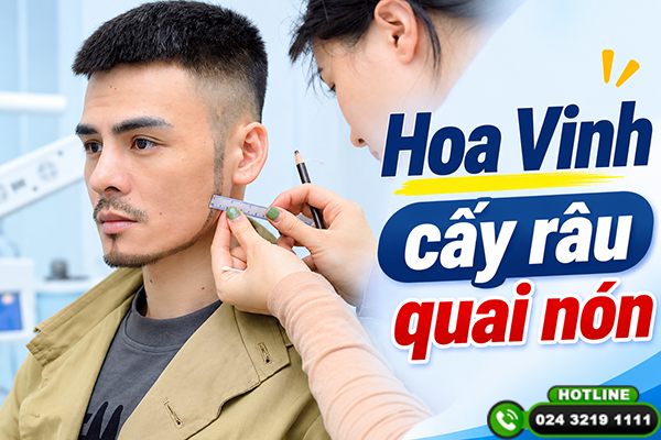 Hoa Vinh cấy râu quai nón: Hành trình thay đổi diện mạo nam tính