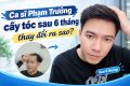 ca sĩ pham trưởng cấy tóc sau 6 tháng thay đổi ra sao