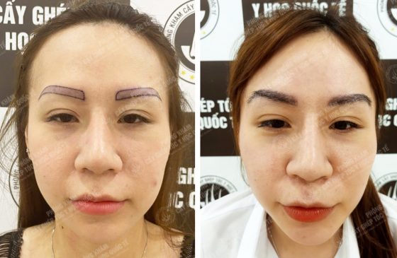 Phạm Kim Loan
