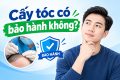 cấy tóc có bảo hành không