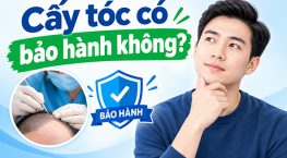 Cấy tóc có bảo hành không? Chính sách cam kết và quyền lợi cần biết