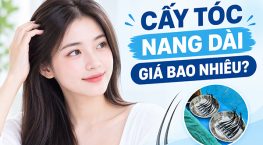 Cấy tóc nang dài giá bao nhiêu? Bảng giá và địa chỉ thực hiện