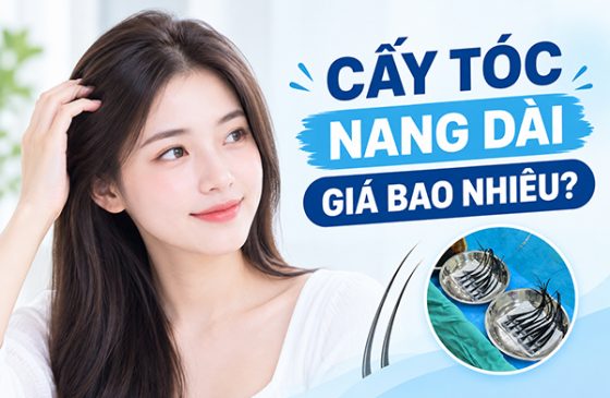 cấy tóc nang dài giá bao nhiêu