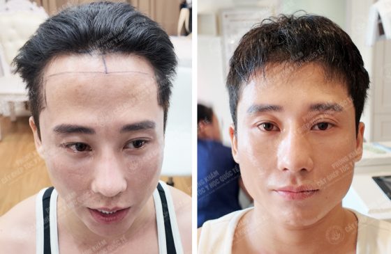 Nguyễn Thế Việt