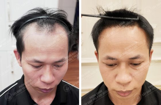 Nguyễn Đức Độ
