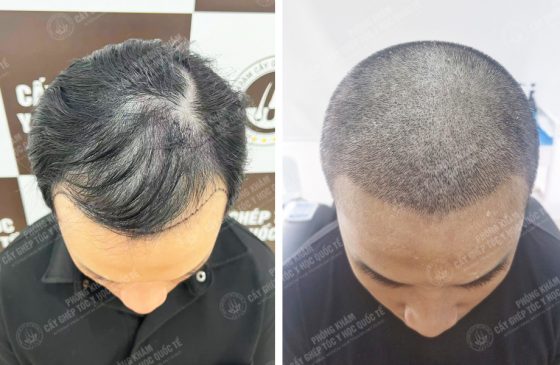Trần Đức Viễn