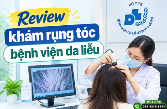 Review khám rụng tóc bệnh viện da liễu: Quy trình, chi phí cụ thể
