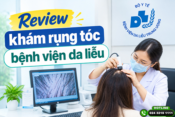 Review khám rụng tóc bệnh viện da liễu: Quy trình, chi phí cụ thể