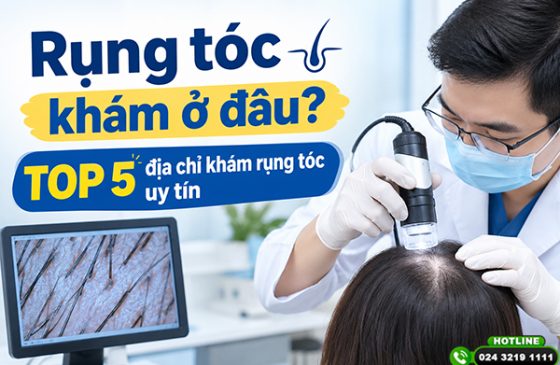Rụng tóc khám ở đâu? TOP 5 địa chỉ khám rụng tóc uy tín