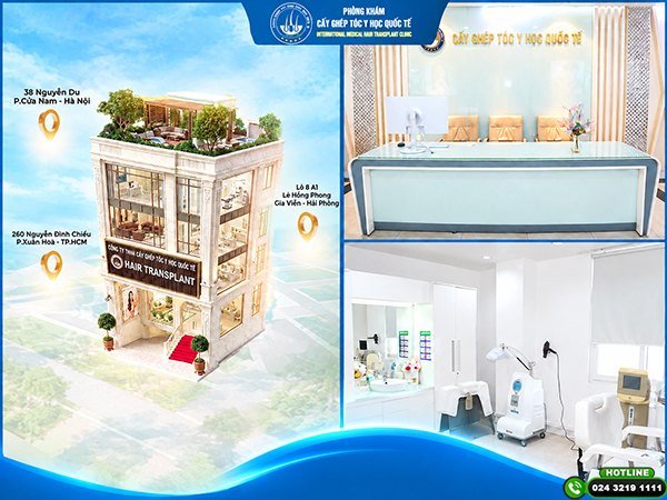 trung tâm cấy ghép tóc y học quốc tế
