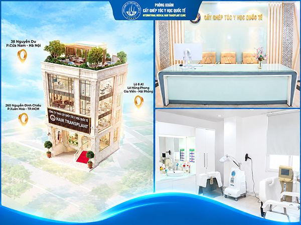 trung tâm cấy ghép tóc y học quốc tế